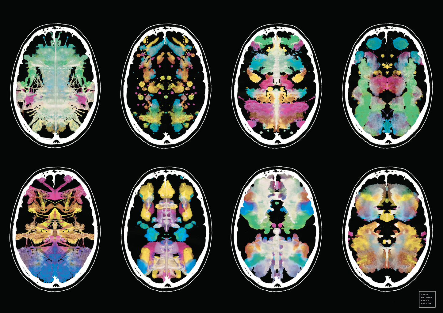 Brain Scan Print 420x279mm A3