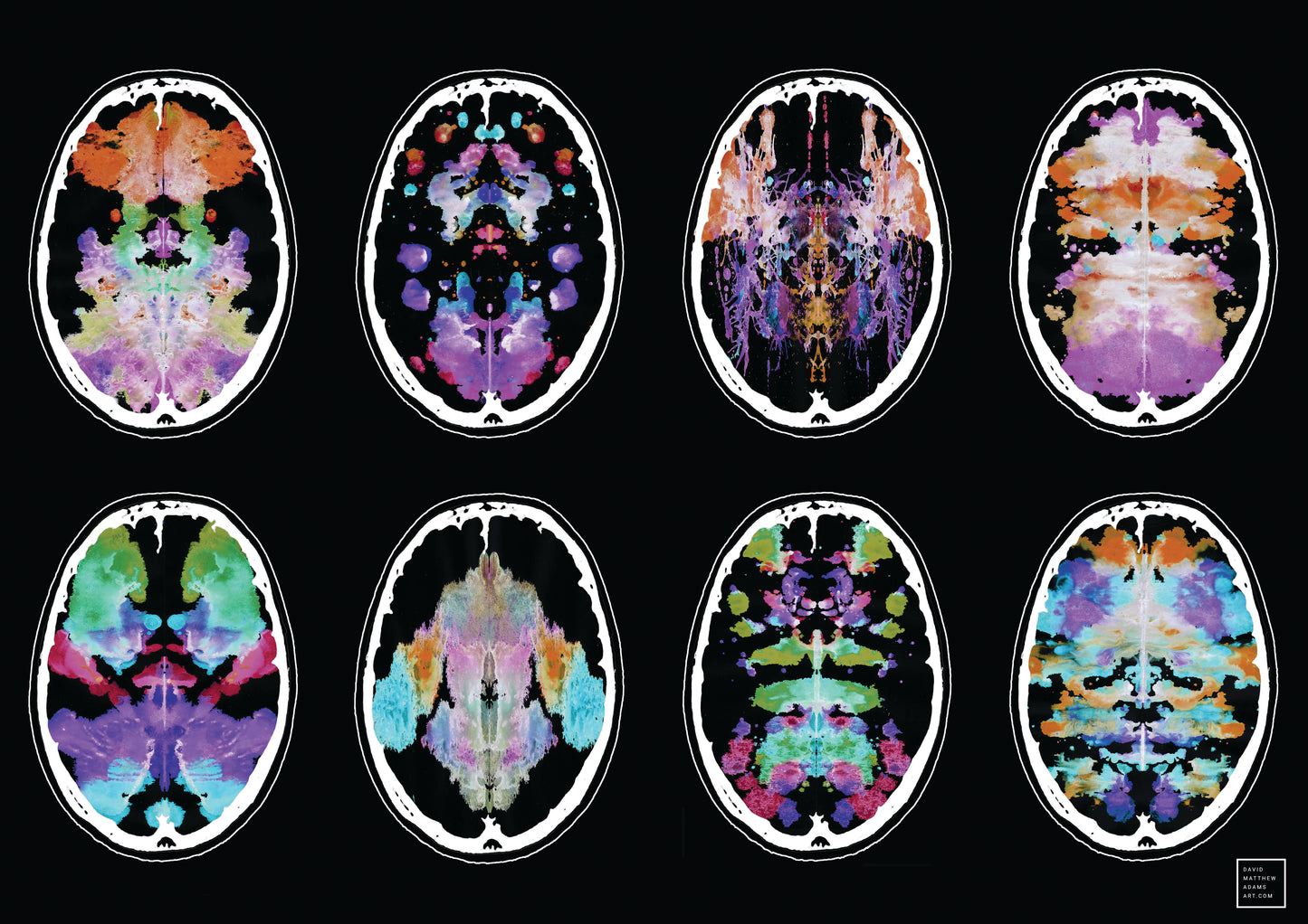 Brain Scan Print 420x279mm A3